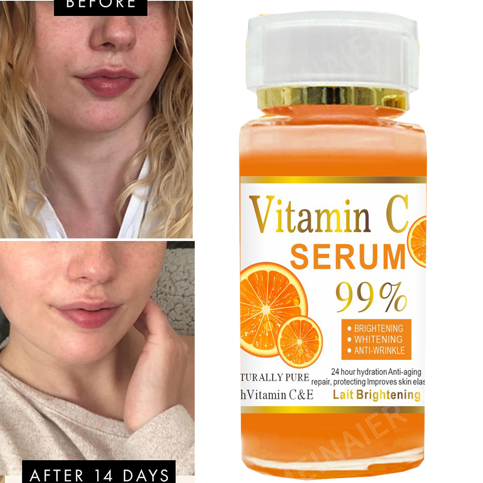 Vitamin C Serum - 슈퍼 120ml 비타민 C 세럼 안티