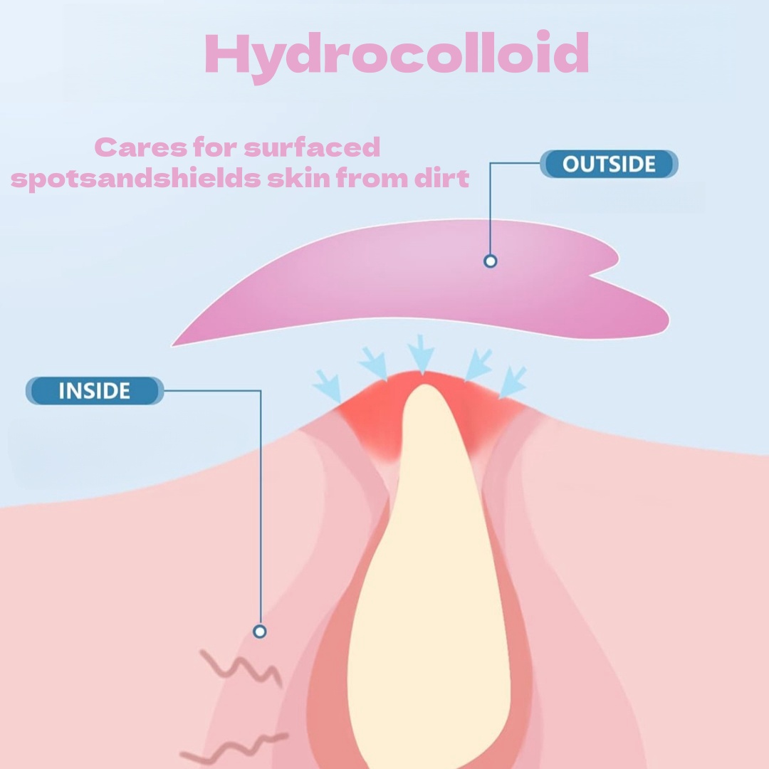 멋진 새로운 여드름 패치 하트/별 모양 보습 여드름 패 - Face Moisturizer 리뷰 및 가격