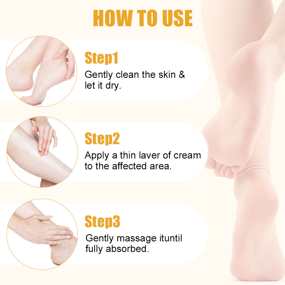 우레아 크림 60% 살리실산 2% 발 핸드 케어 크림  - Urea Foot Cream 리뷰 및 가격