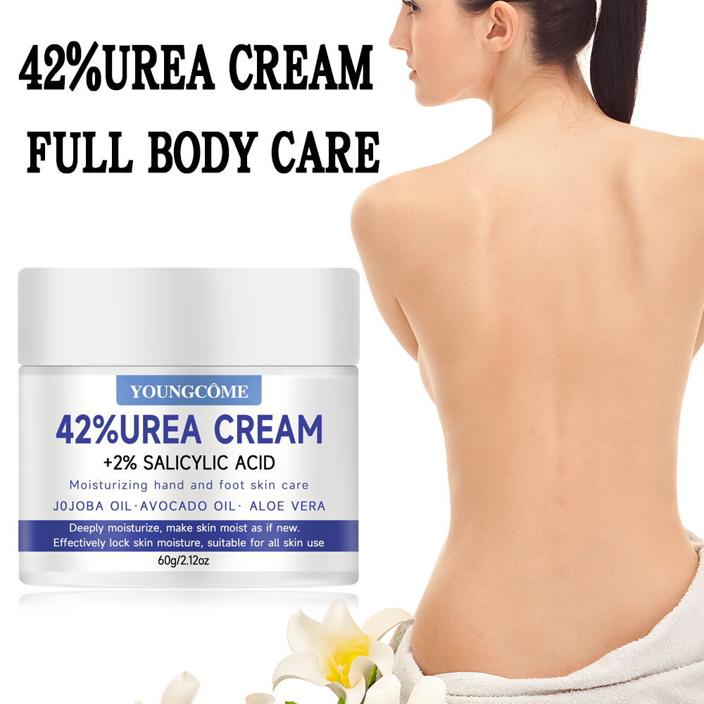 YOUNGCOME 42% 요소 크림 및 2% 살리실산  - Urea Foot Cream 리뷰 및 가격