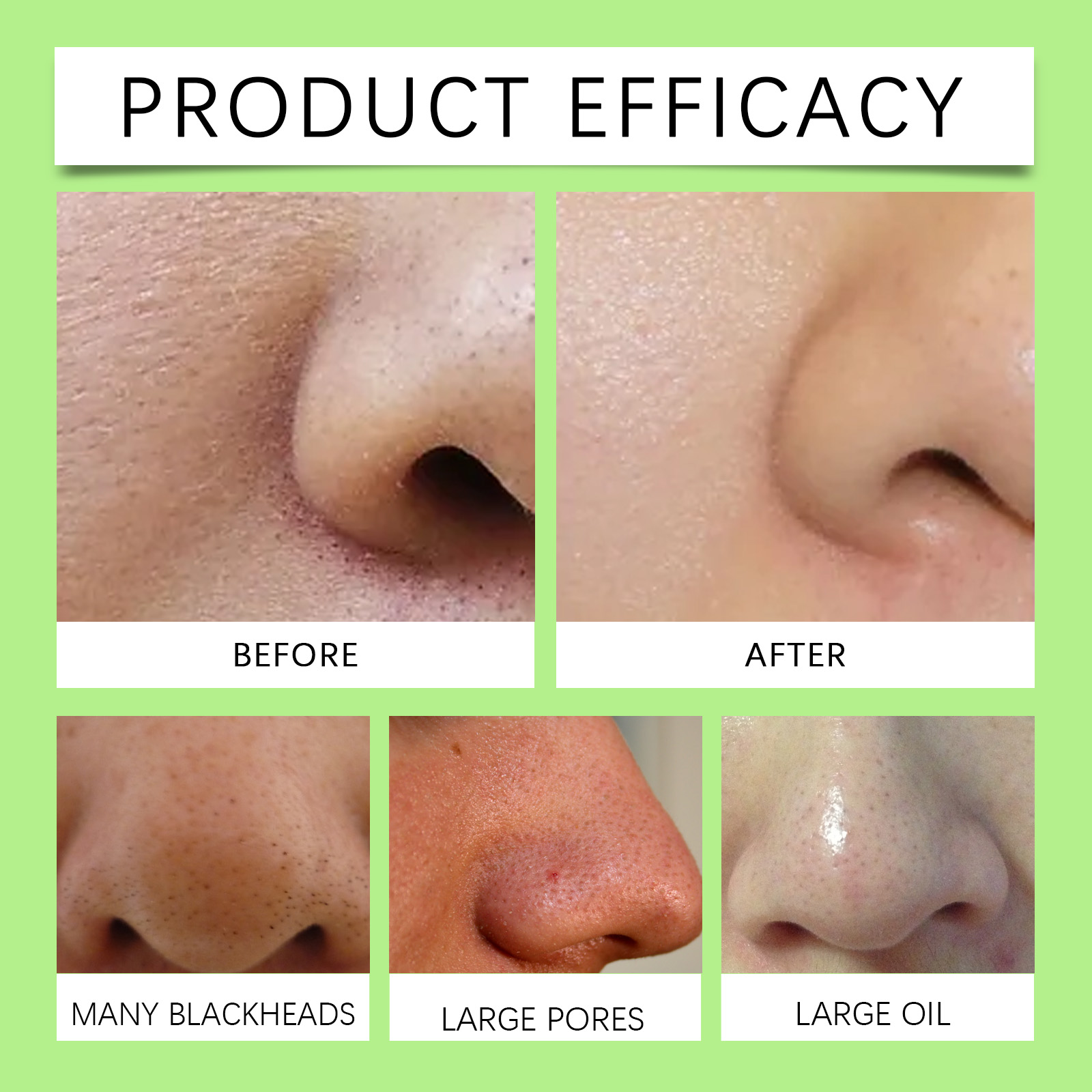 대나무 숯 코팩 블랙헤드 제거용 72매 + 무료 30m - Skincare China 리뷰 및 가격