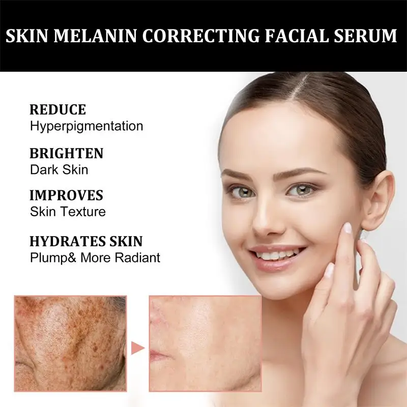 멜라닌 페이셜 리페어 세럼, 보습 리페어, 어두운 피부 - Vitamin C Serum 리뷰 및 가격