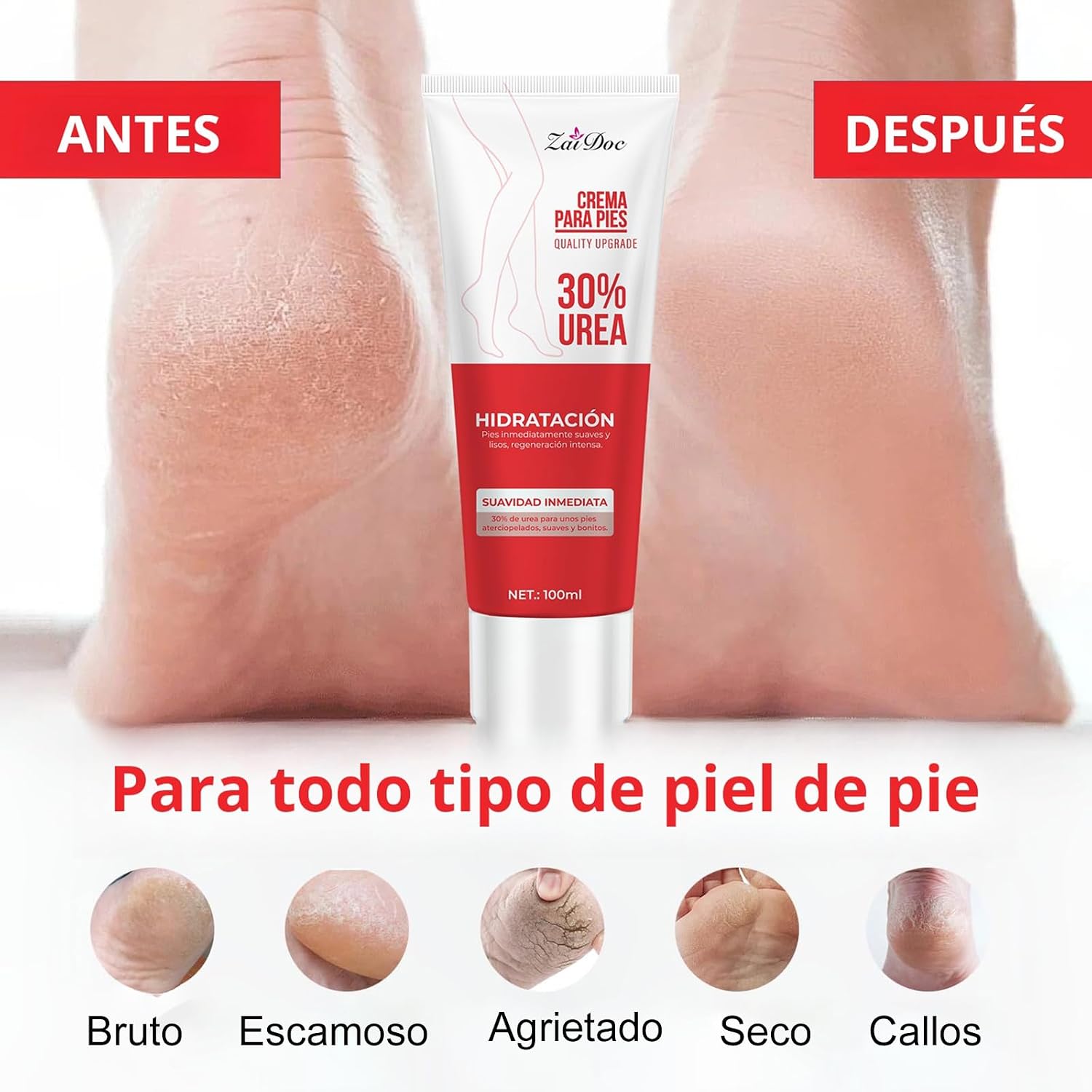 자이닥(ZaiDoc) 2개 또는 4개 세트, 요소 함유 - Urea Foot Cream 리뷰 및 가격