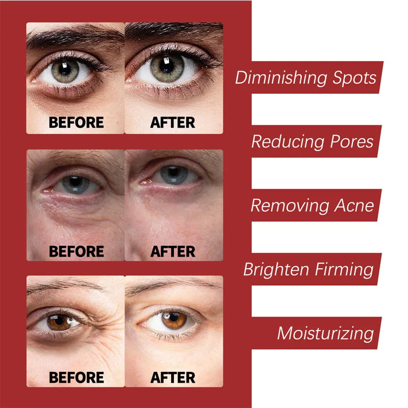 레티놀 크림 보습 스킨 케어 한국 화장품 - Retinol Cream 리뷰 및 가격