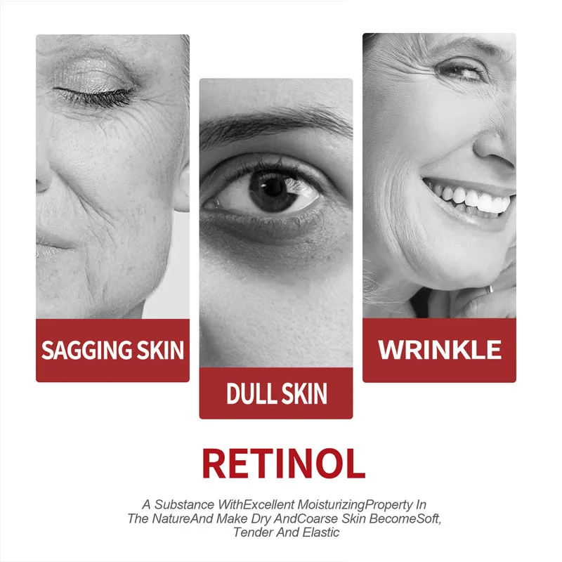 레티놀 크림 보습 스킨 케어 한국 화장품 - Retinol Cream 리뷰 및 가격