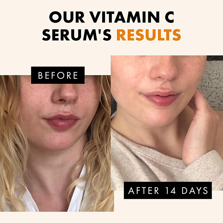 슈퍼 120ml 비타민 C 세럼 안티 에이징 화이트닝  - Vitamin C Serum 리뷰 및 가격